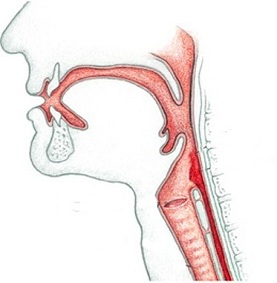 respiratory insufficiency