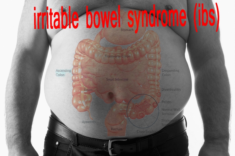 Irritable Bowel Syndrome